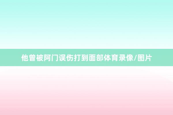 他曾被阿门误伤打到面部体育录像/图片